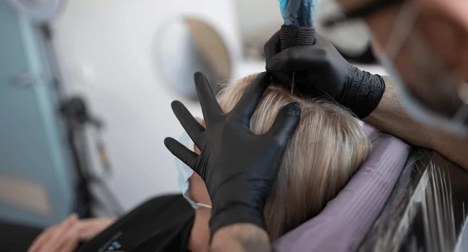 A Foli Sim client with scalp micropigmentation for thinning hair
