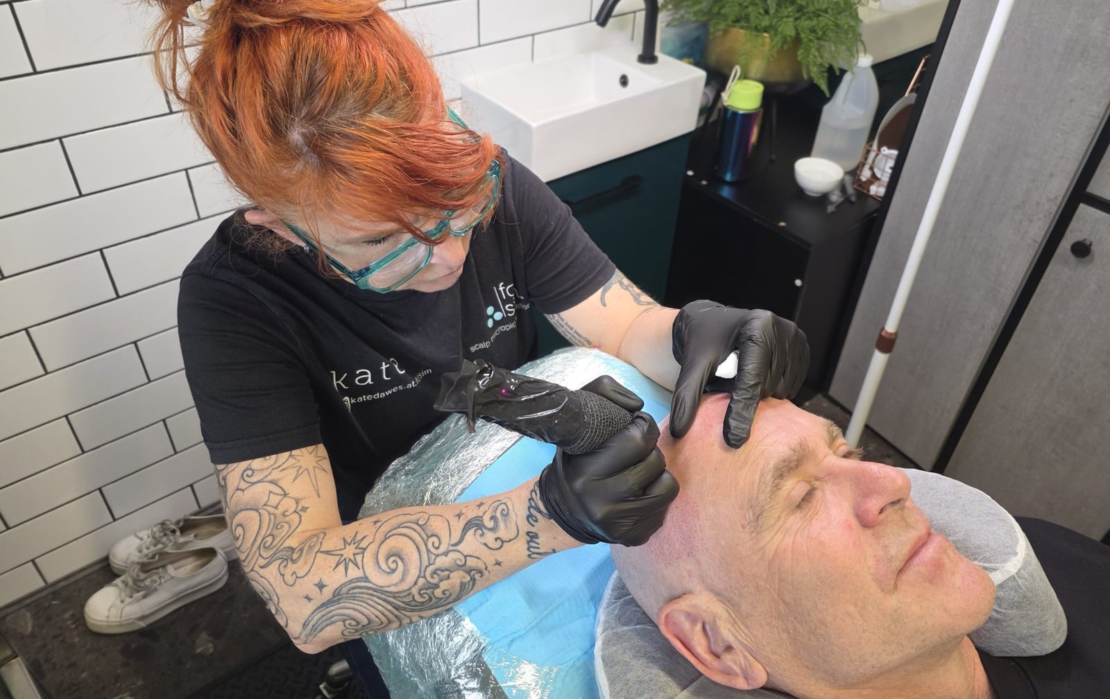 Scalp micropigmentation maintenance: what to expect from fading and touch-ups