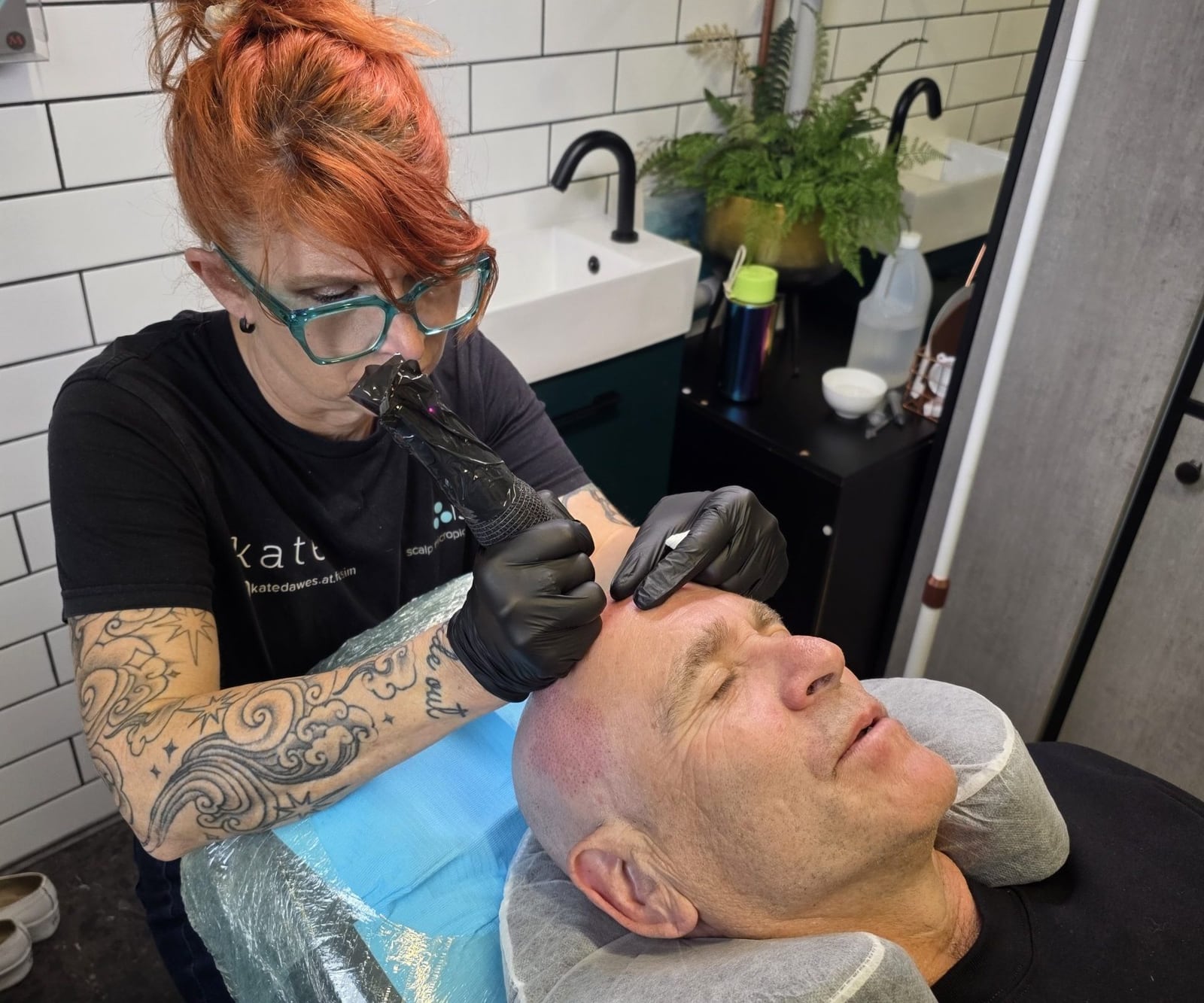 A Foli Sim artist treating alopecia with scalp micropigmentation