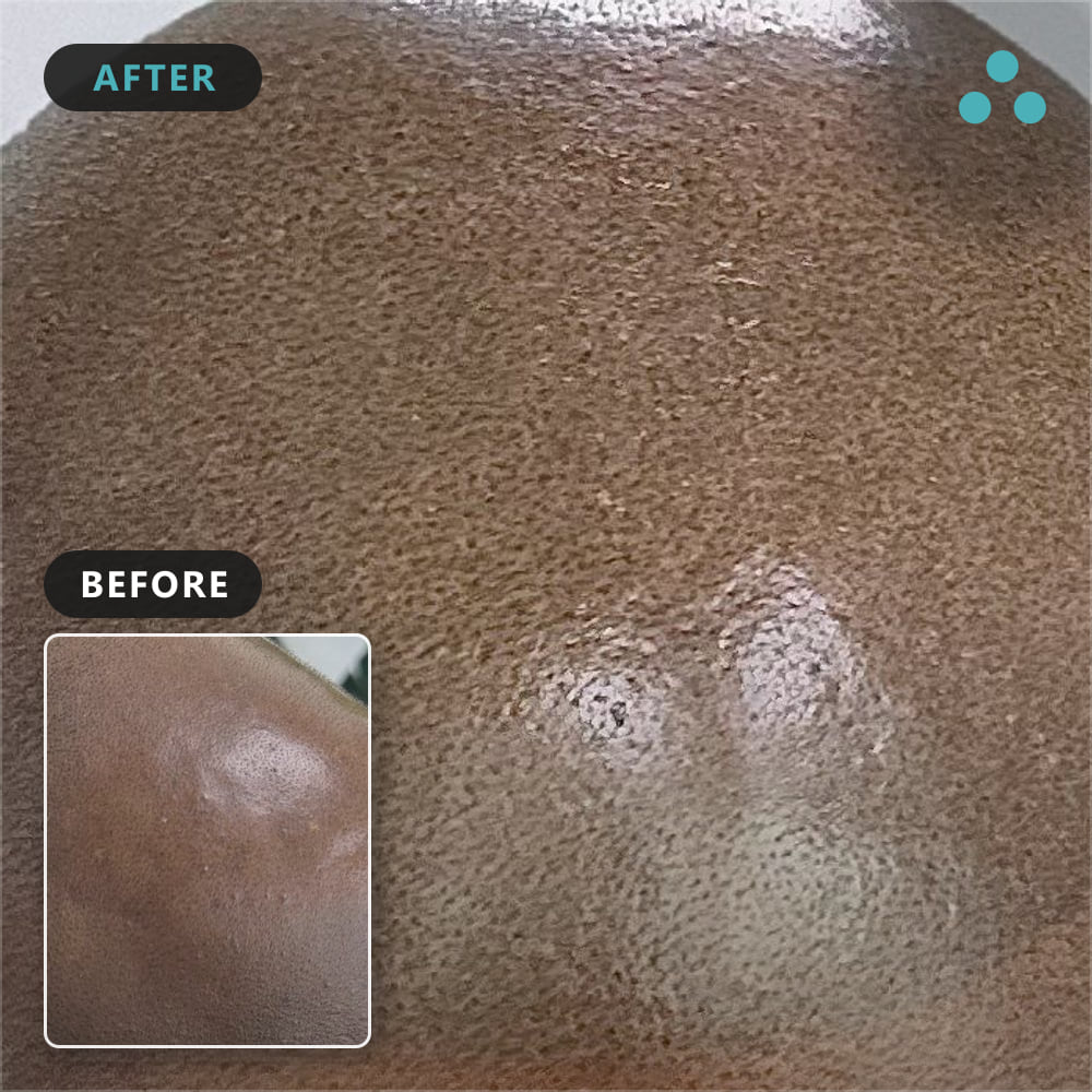 04 anthony okoye dark skin conceal identity, Foli Sim