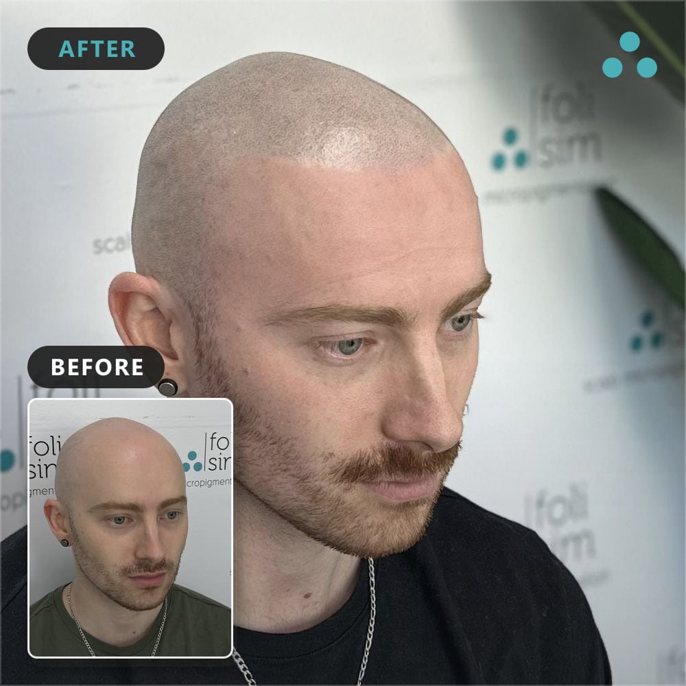 10 calvin fisher ok to show identity, Foli Sim