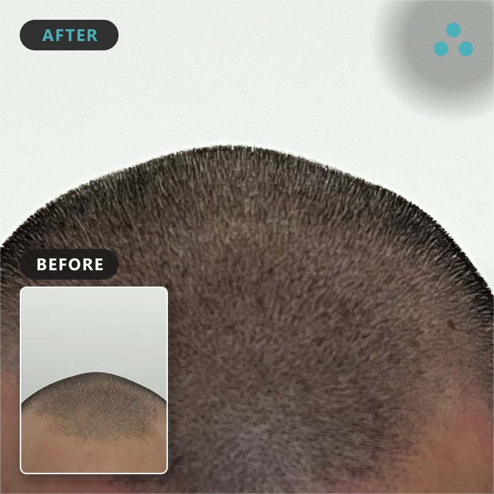 34 wade nila conceal identity, Foli Sim