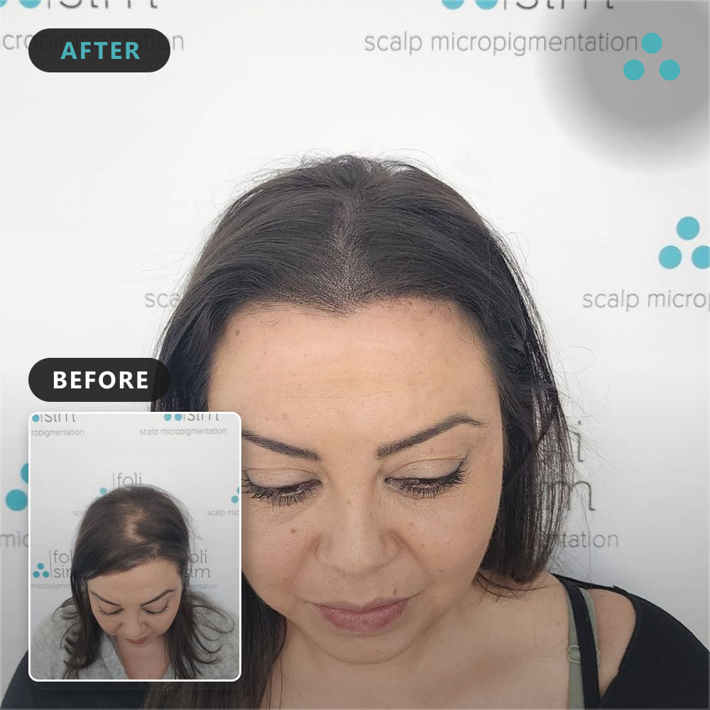 50 serap aslan can show full identity, Foli Sim
