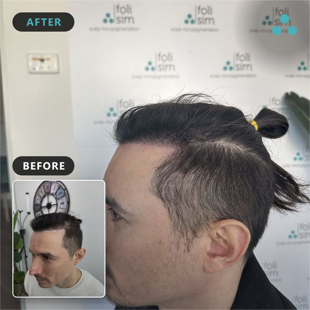 74 mark barber ok to show face, Foli Sim