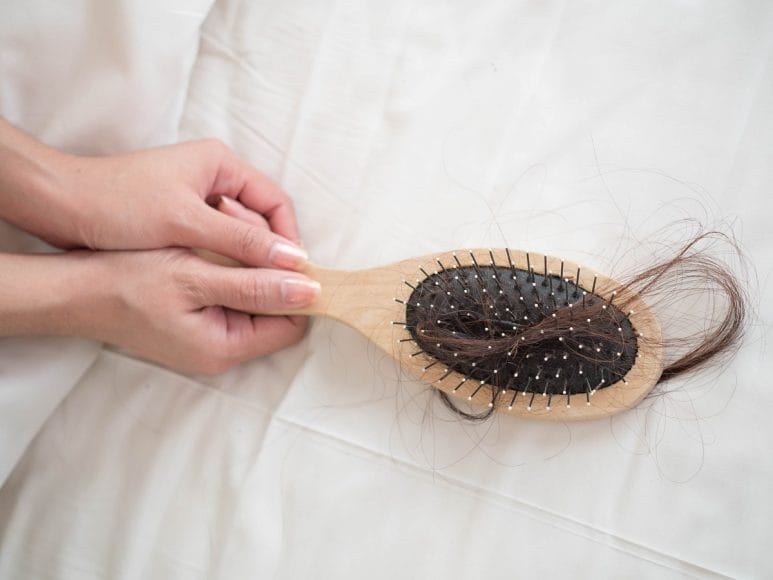 Common causes of hair loss in women