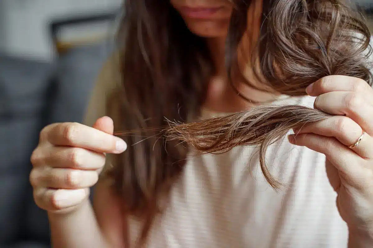 Does Stress Cause Hair Loss? What You Need to Know