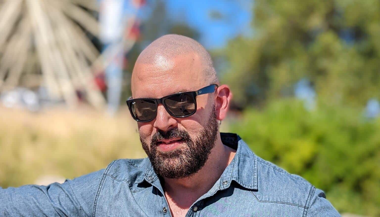 Do hair tattoos fade? How long does scalp micropigmentation last?