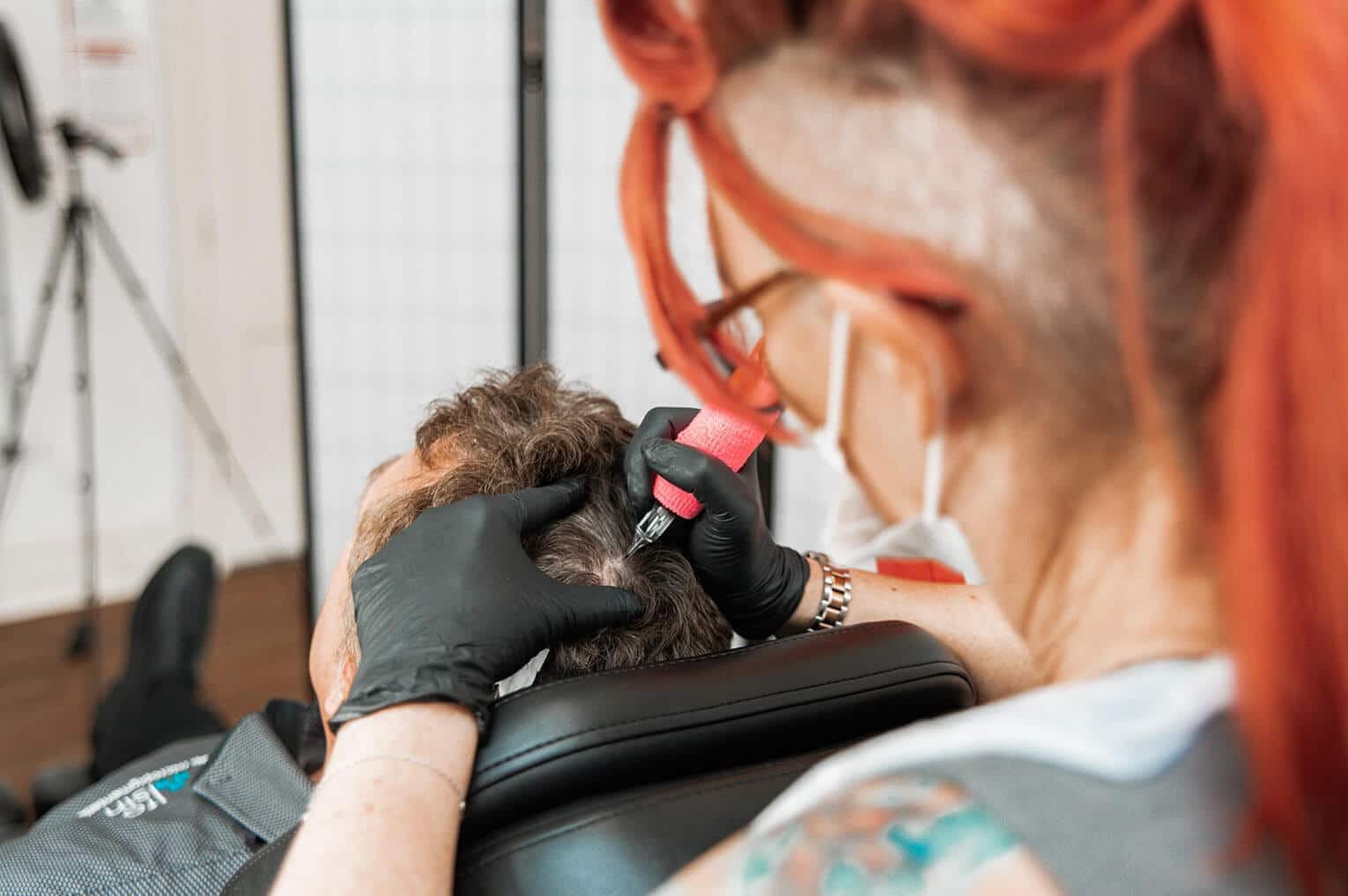Can I Combine a Hair Tattoo with a Hair Transplant?