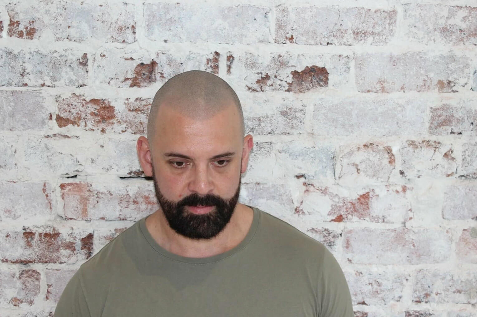 Hair loss and Self Image