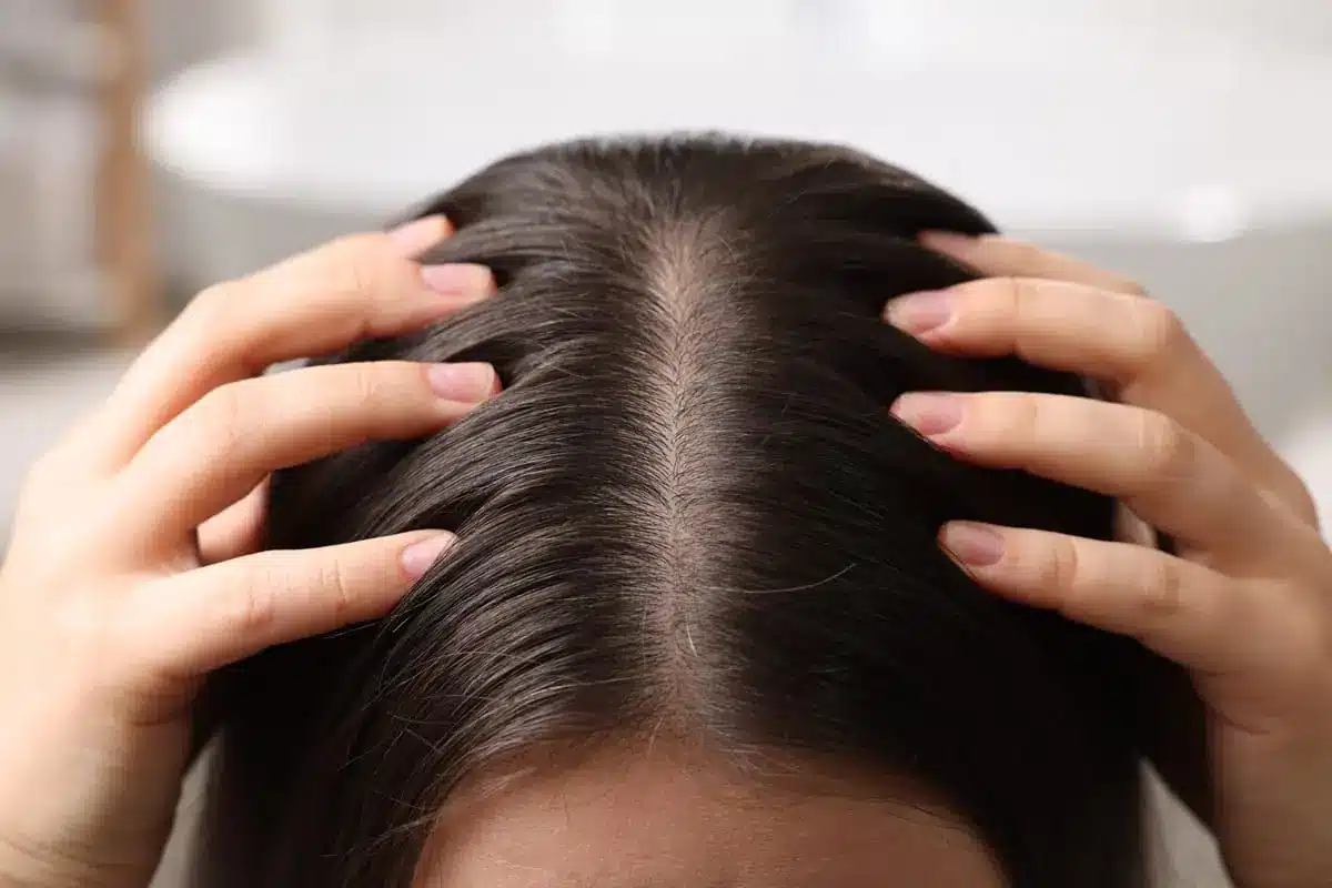 Tips on How to Improve Scalp Health