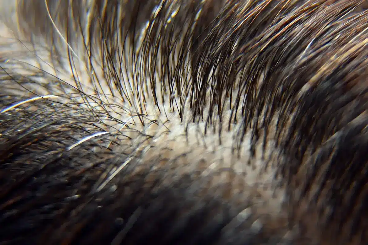 5 facts about SMP density on longer, unshaved hair