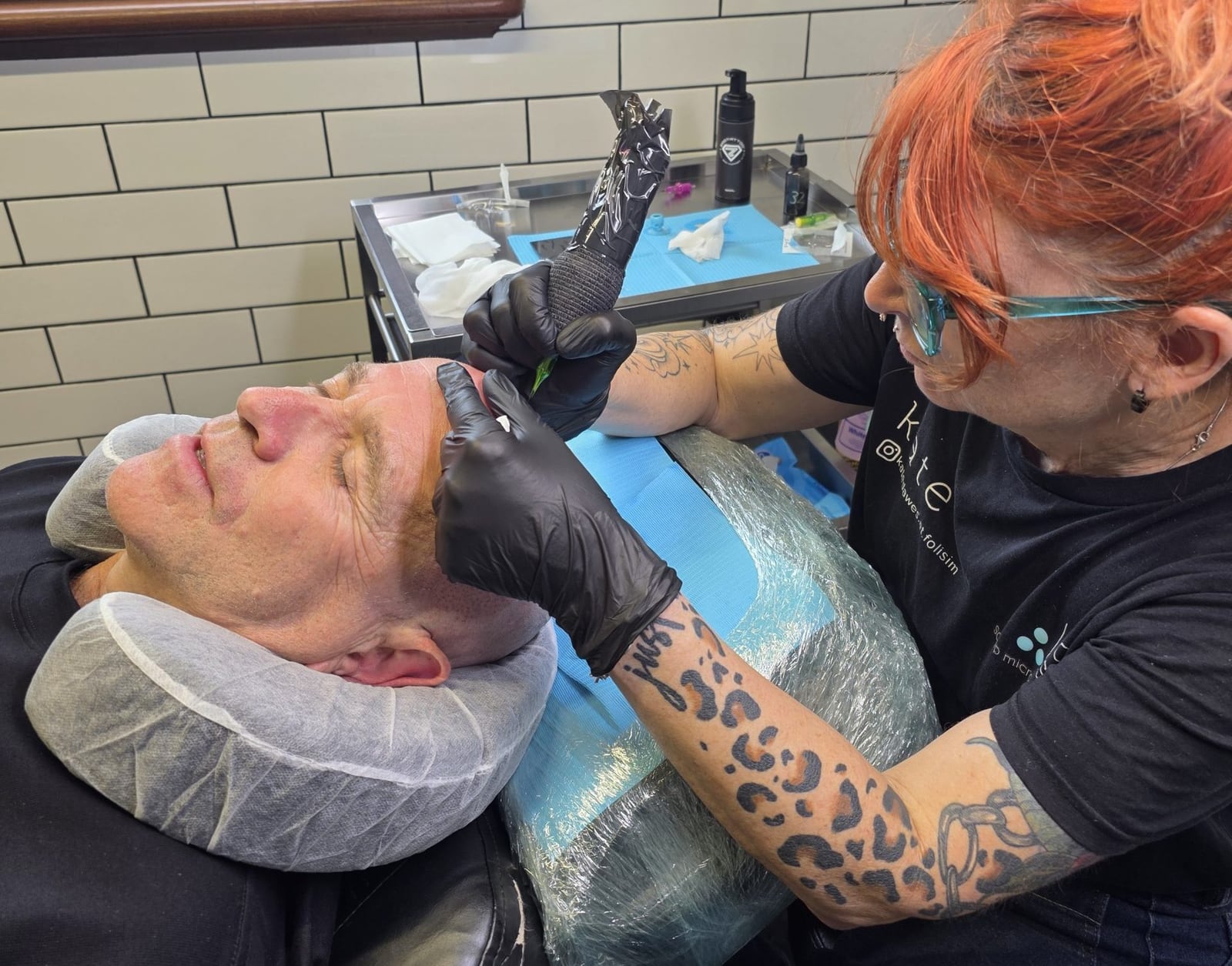 What Is Scalp Micropigmentation scaled, Foli Sim