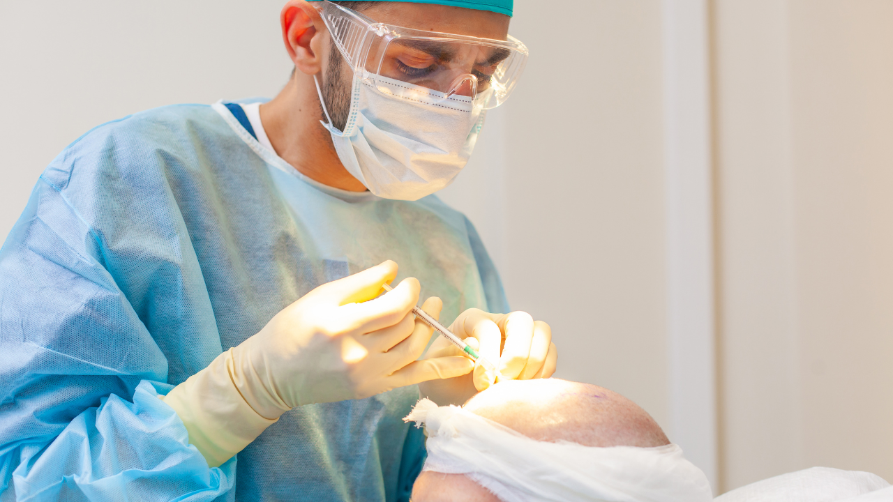 What Is a Hair Transplant, Foli Sim