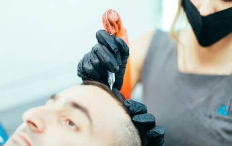 Hair replacement systems
