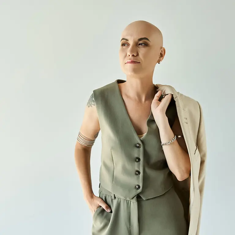 SMP for alopecia