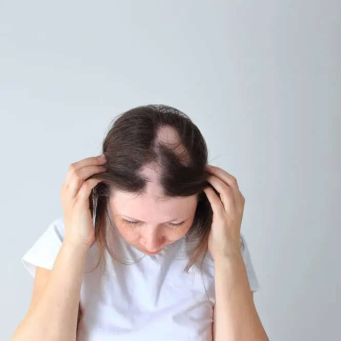 Alopecia in children, Foli Sim