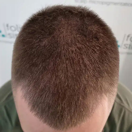 3after