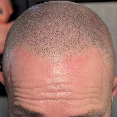 6after