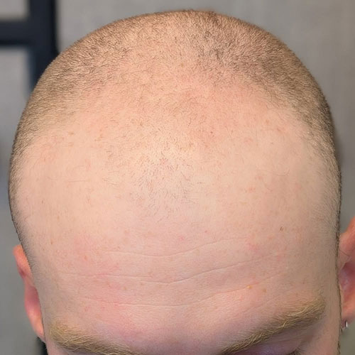 9before